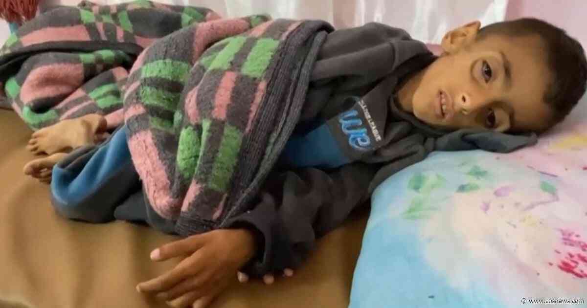 Gaza doctor says lack of food and aid has led to "catastrophic" situation