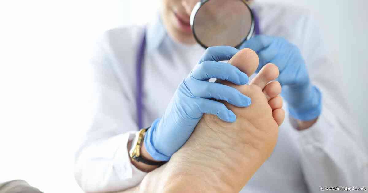 Pharmacist shares eight health warning signs that appear on feet and toenails