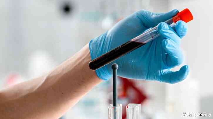 EEUU aprueba el primer test sanguíneo para ayudar a detectar el Alzhéimer