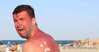 Dermatologist warns three sunburn ‘remedies’ could cause chemical burns - and two that actually work