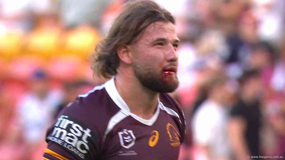 Broncos star bloodied, sore in big scare; winger hurt amid DCE call, veteran snub — QLD team LIVE