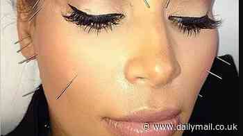 I tried face acupuncture, just like Kim Kardashian, at the 'edgy' Standard Spa in Miami... and I was shocked by what it did to my appearance