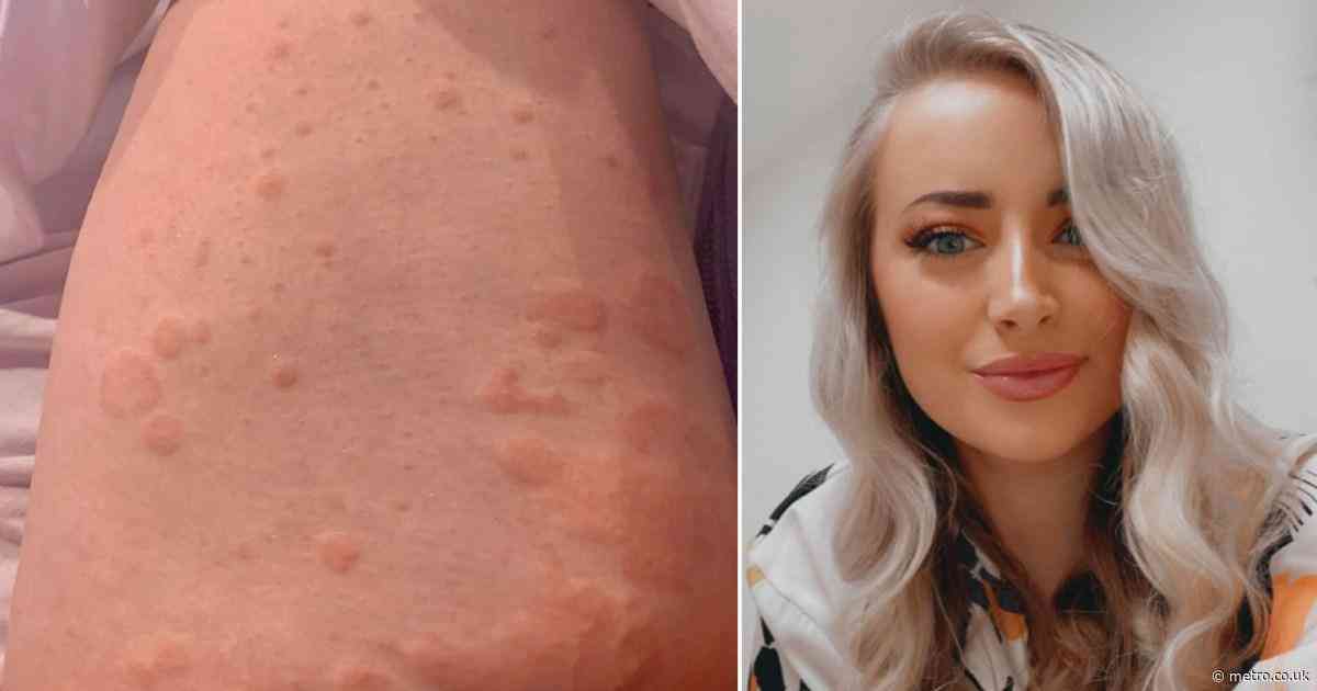 ‘I’m no anti-vaxxer, but I regret getting the Covid jab’