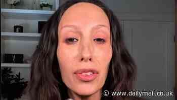 Cheryl Burke, 41,slams critics accusing her of using Ozempic or getting a face transplant