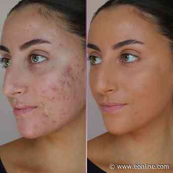 24-Hour Deal: Get 57% Off Doll 10 Foundation That Beats a Photo Filter