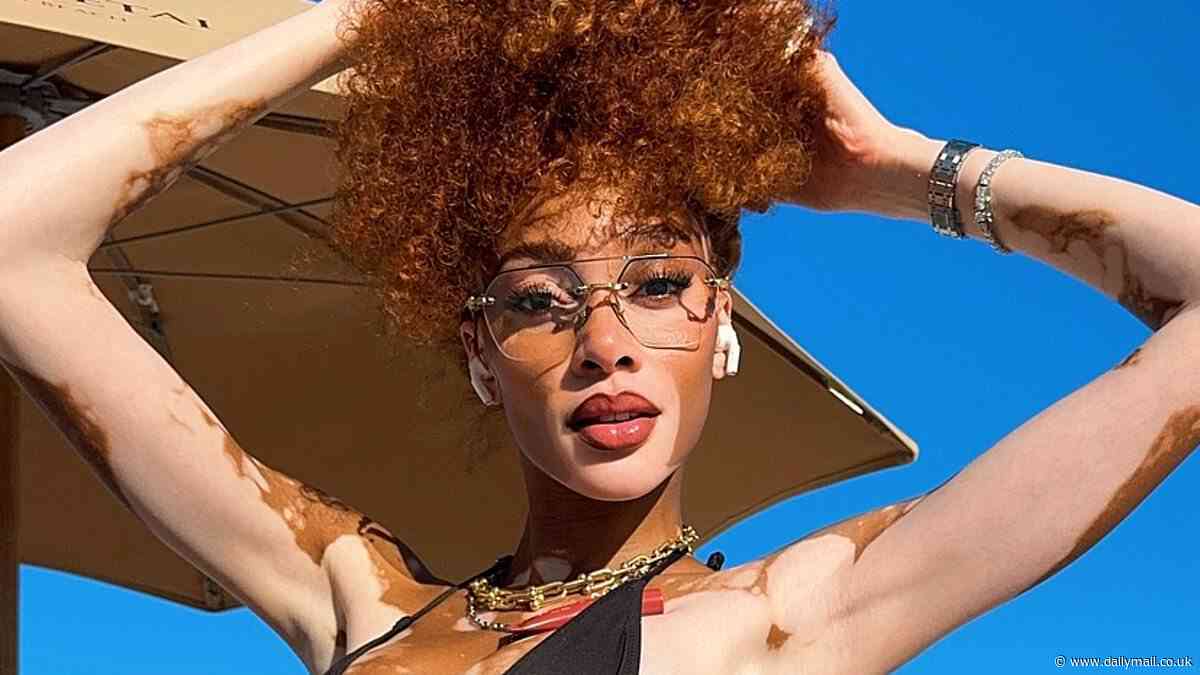 Winnie Harlow cements her model status as she flaunts her jaw-dropping figure in skimpy black bikini for sizzling beach snaps