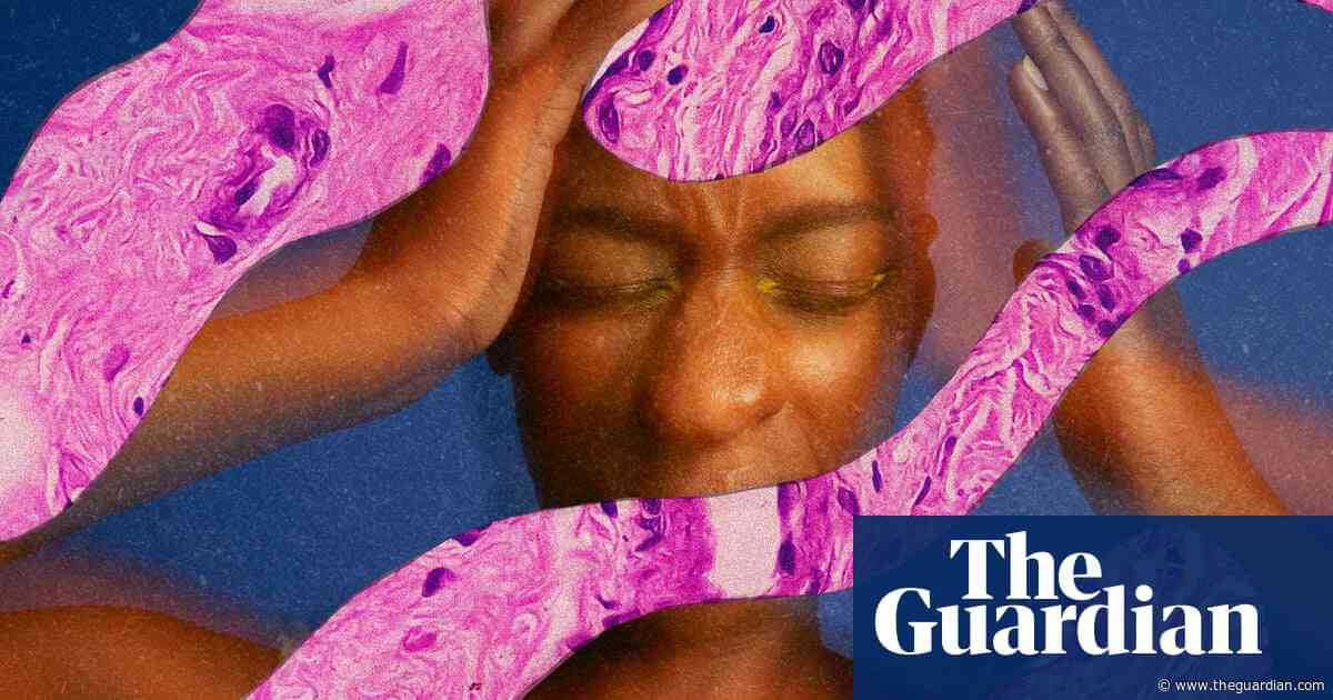 Doctors dismissed my pain. I eventually discovered I had a rare tumor