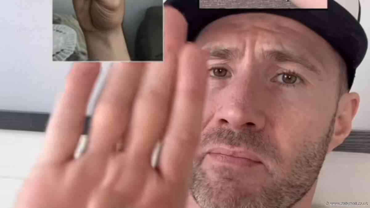 Doctor reveals the simple thumb test that can show a 'ticking time bomb' heart problem