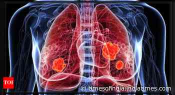 6 early symptoms of Lung Cancer that are easily ignored
