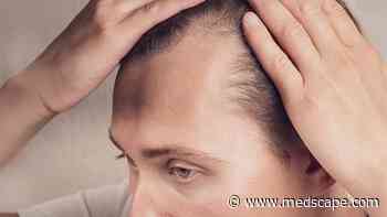Research Links Affluence to Higher Scarring Alopecia Risk