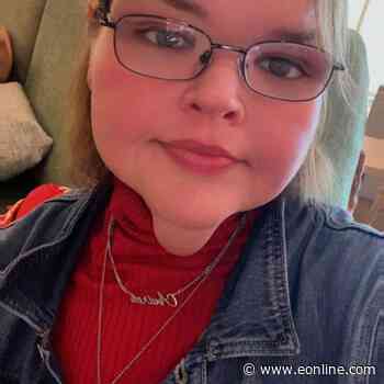 1000-Lb Sisters: Tammy Slaton Reveals Skin Removal Before and After