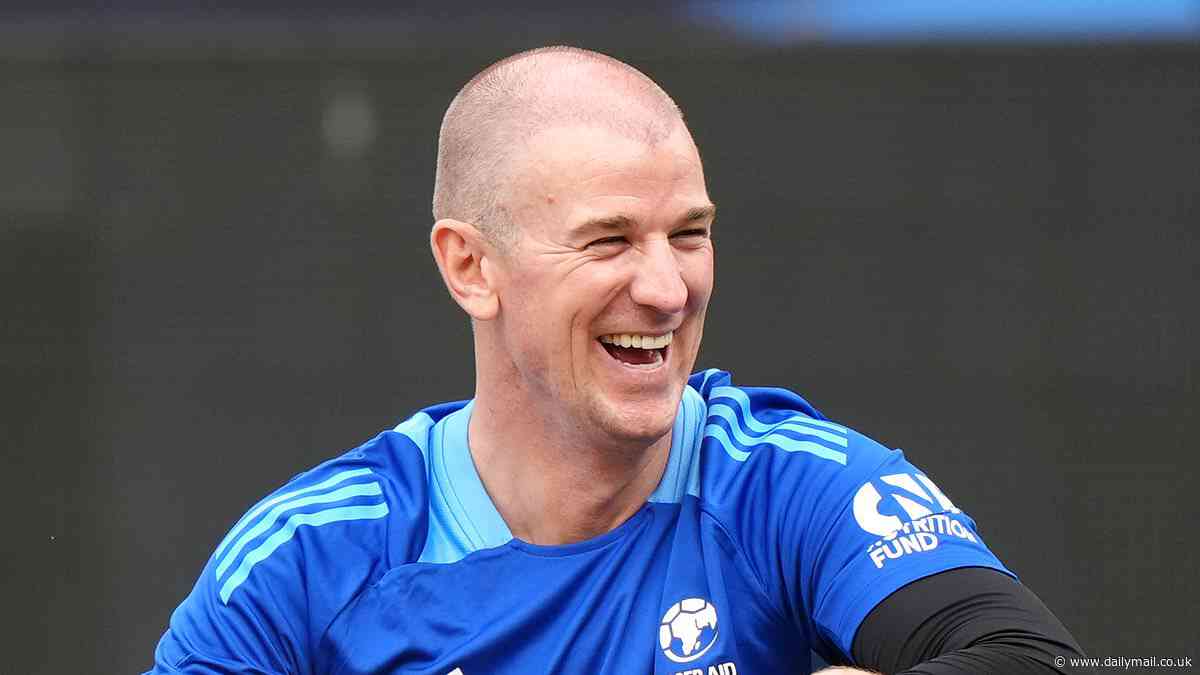 Former England goalkeeper Joe Hart sports fresh scars of hair transplant at Soccer Aid... in a far cry from his days in Head and Shoulders adverts!
