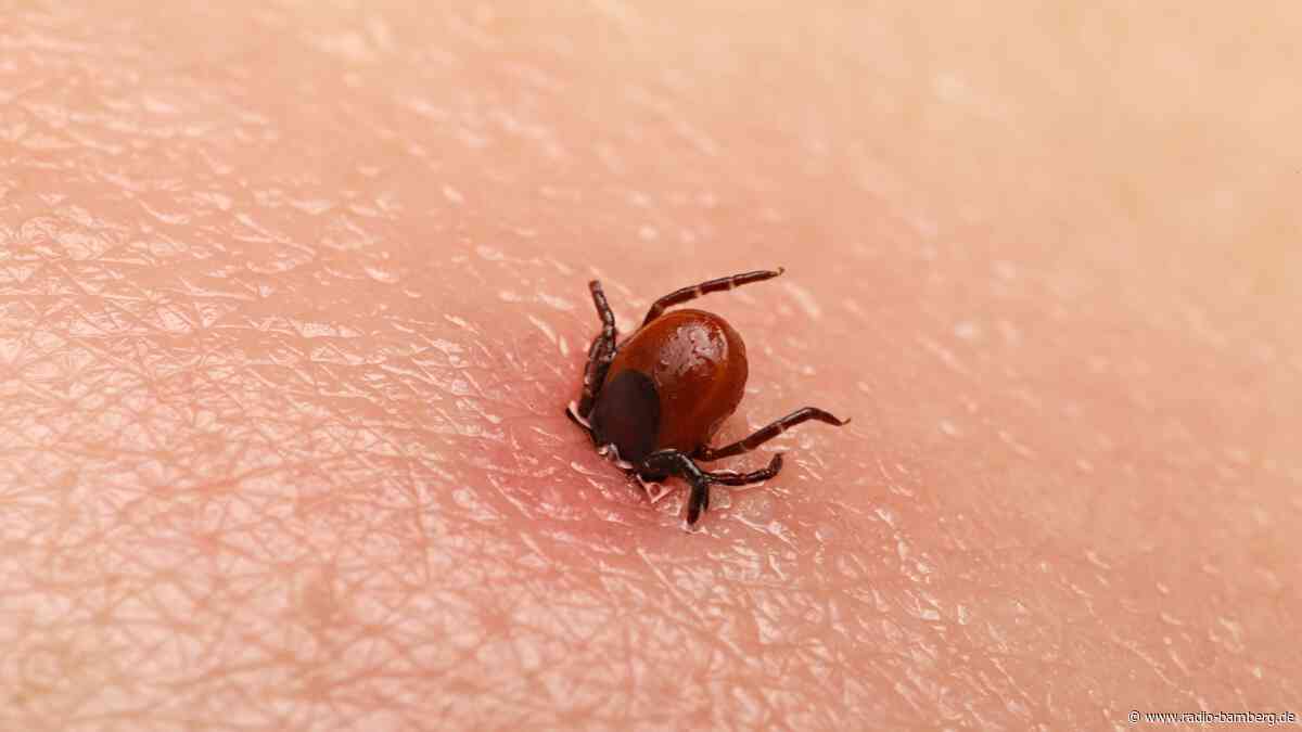 Unfallversicherung bei Zeckenbissen?: Experten raten zur Vertragsumstellung