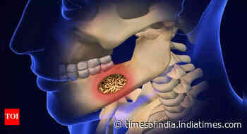 What is Mouth Larvae: Know its causes, symptoms, prevention strategies, and treatment