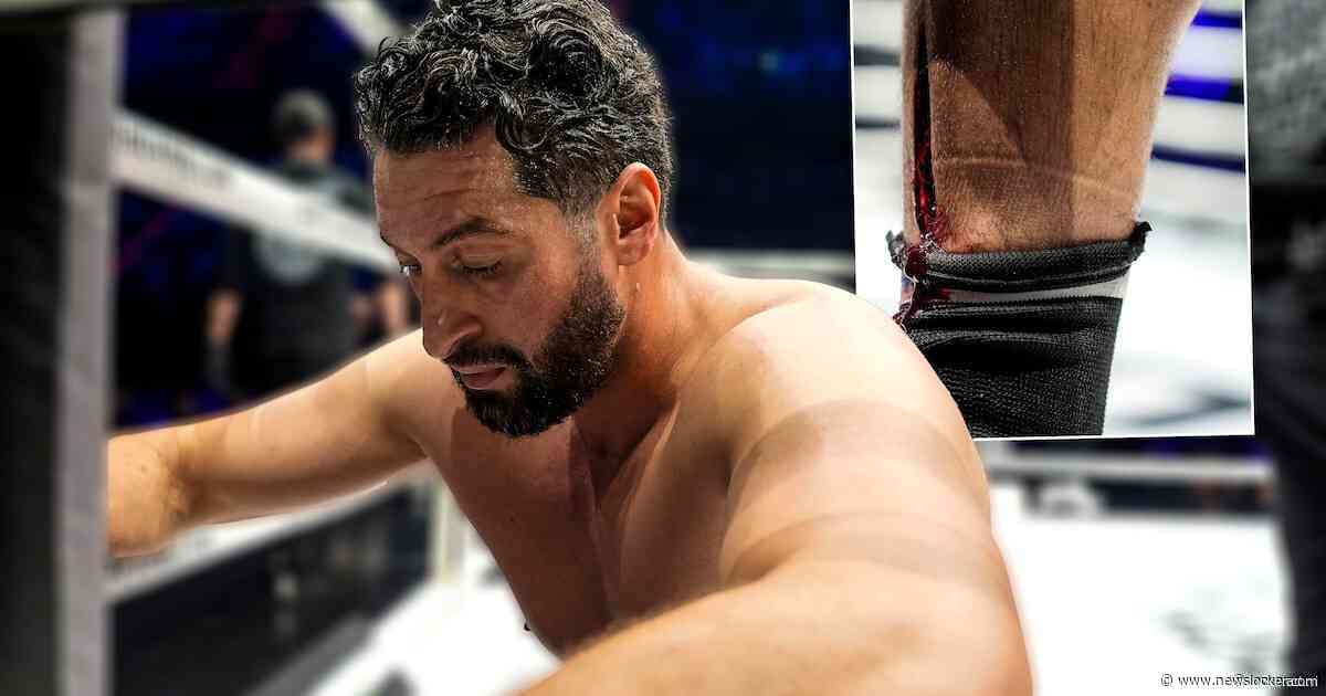 Jamal Ben Saddik vecht tegen tranen in Ahoy, diepe snee beëindigt gevecht: ‘Gaan zo veel emoties door me heen’