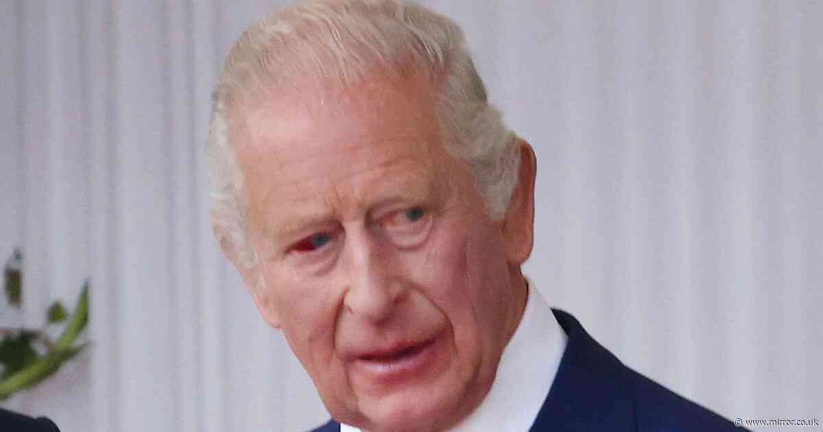 King Charles spotted with bloodshot eye in Macron visit as health condition explained