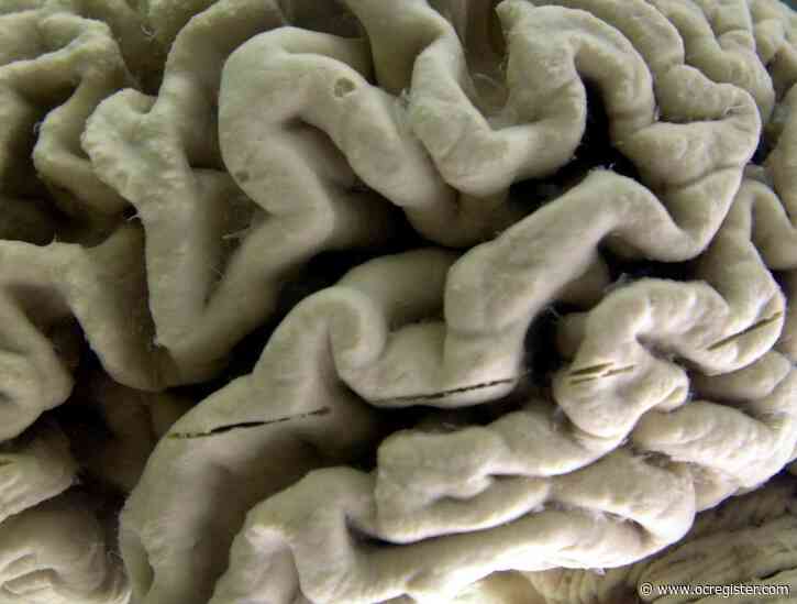 Should dementia and other patients be able to choose death?