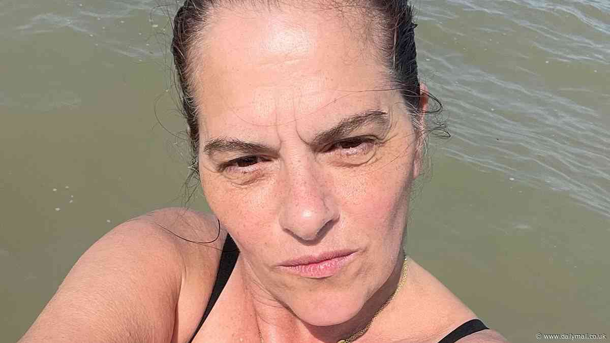 Tracey Emin shares powerful topless snap showing her stoma bag as she marks her 62nd birthday after extensive bladder cancer surgery