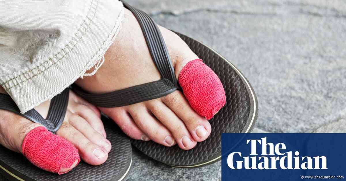 What are ingrown toenails, and how can I avoid them?